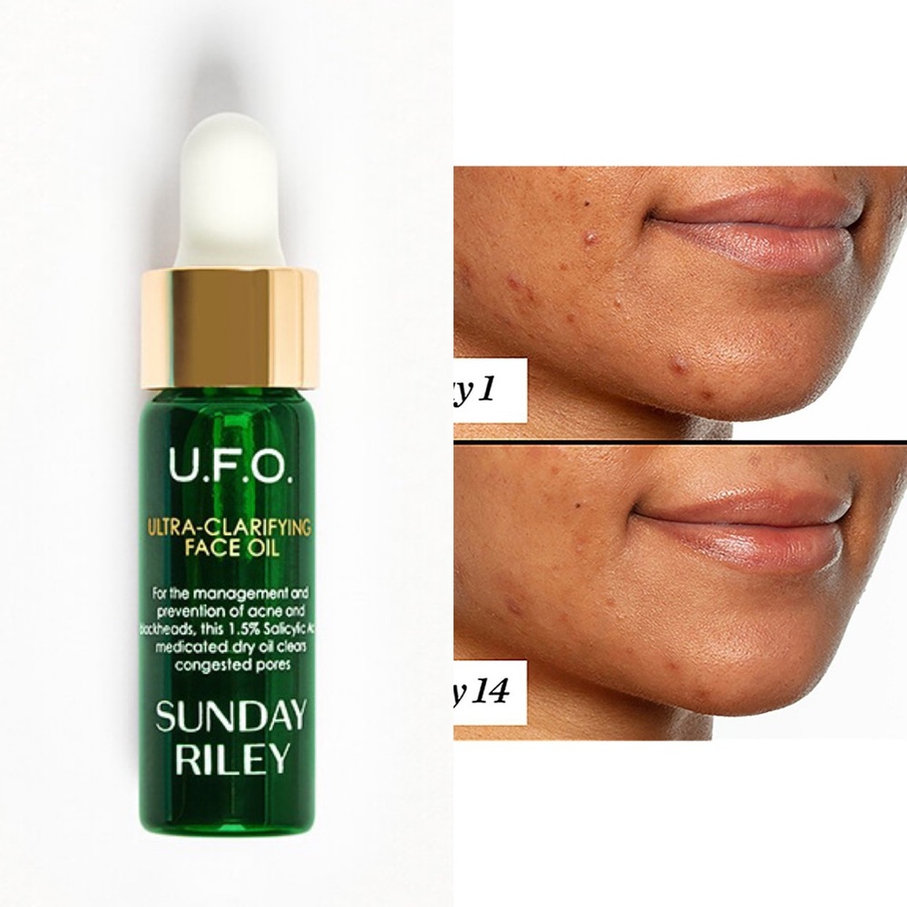 ULTRA-CLARIFYING ACNE TREATMENT FACE OIL